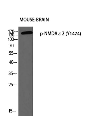 NMDAε2 (phospho Tyr1474) rabbit pAb - image 1