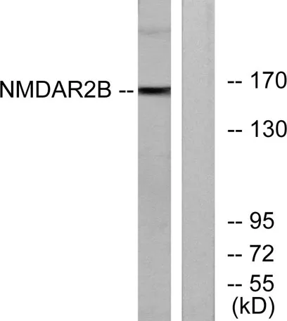 NMDAε2 rabbit pAb