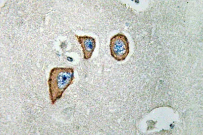 NMDAε3 rabbit pAb