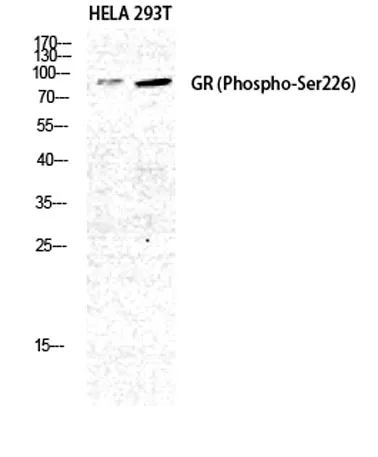 GR (phospho Ser226) rabbit pAb - image 1