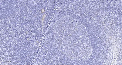 TBK1 rabbit pAb - image 1