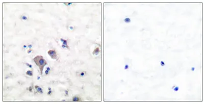 mGluR-2/3 rabbit pAb