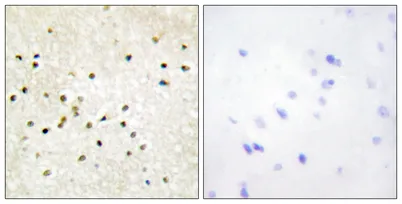 TFIIH p62 rabbit pAb - image 1