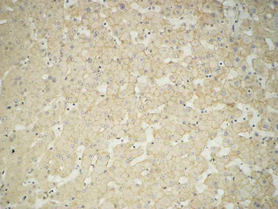 Glucuronidase β rabbit pAb - image 1