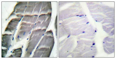 Glycogen Synthase 1 rabbit pAb - image 1