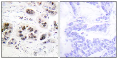 Acetyl Histone H2A (K5) rabbit pAb - image 1
