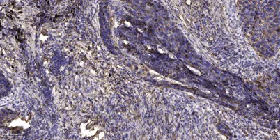 Lck BP-1 (phospho Tyr378) rabbit pAb - image 1