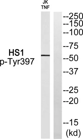 Lck BP-1 (phospho Tyr397) rabbit pAb - image 1