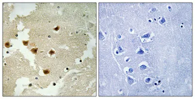 Huntingtin (phospho Ser421) rabbit pAb