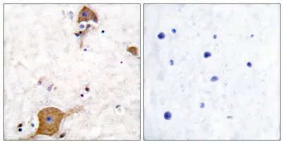 Neuregulin-1 SMDF rabbit pAb - image 1