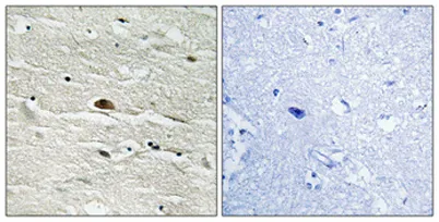 HMG-14 (phospho Ser21) rabbit pAb - image 1