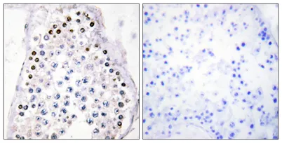 Hox-A1/B1/D1 rabbit pAb