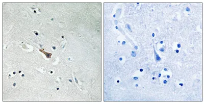 APLP2 (phospho Tyr755) rabbit pAb - image 1