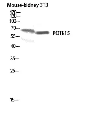 POTE15 rabbit pAb