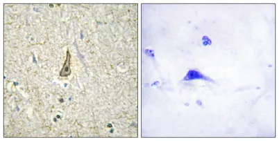 CYP26C1 rabbit pAb