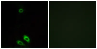 AKR1CL1 rabbit pAb