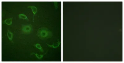 IFN-α/βRα rabbit pAb - image 1