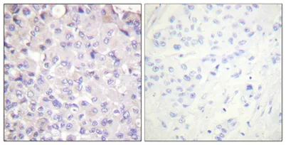 IKKβ (phospho Tyr188) rabbit pAb - image 1