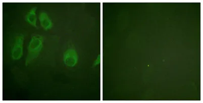 IL-2Rα rabbit pAb - image 1