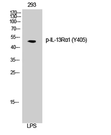 IL-13Rα1 (phospho Tyr405) rabbit pAb - image 1