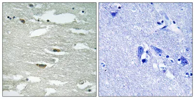 ILK (phospho Ser246) rabbit pAb - image 1
