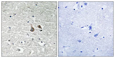 IRAK-1 (phospho Ser376) rabbit pAb - image 1