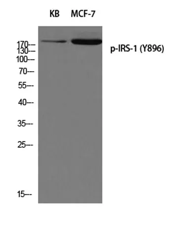 IRS-1 (phospho Tyr896) rabbit pAb - image 1