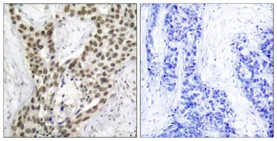 AR (phospho Ser213) rabbit pAb - image 1
