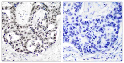 AR (phospho Ser650) rabbit pAb