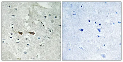 Integrin α4 (phospho Ser1027) rabbit pAb - image 1