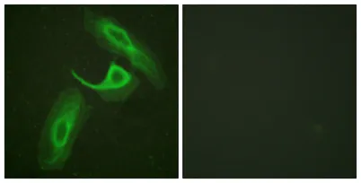 Integrin β2 rabbit pAb - image 1