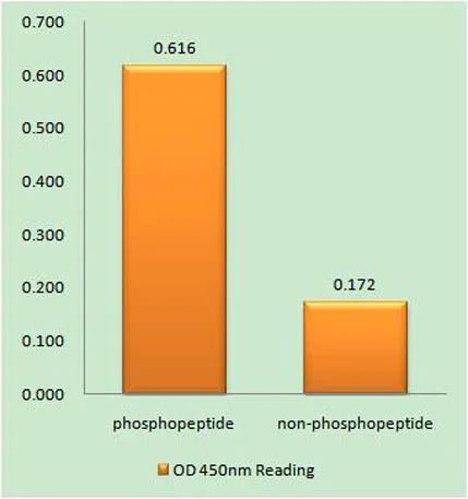IP3R-I (phospho Ser1598) rabbit pAb - image 1