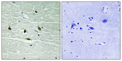 JAK2 (phospho Tyr119) rabbit pAb - image 1