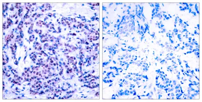Jun D (phospho Ser255) rabbit pAb - image 1