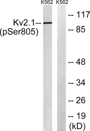 KV2.1 (phospho Ser805) rabbit pAb - image 1