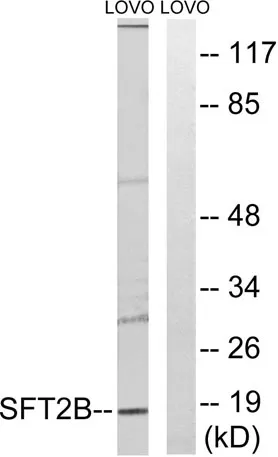 SFT2D2 rabbit pAb