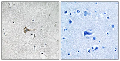 Kv4.2 rabbit pAb - image 1