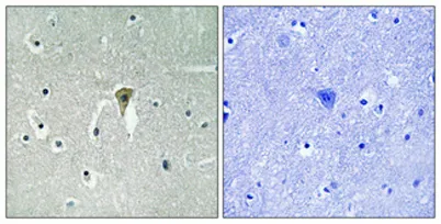 KIR6.2 (phospho Thr224) rabbit pAb