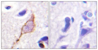 KCNQ2/3/4/5 rabbit pAb - image 1
