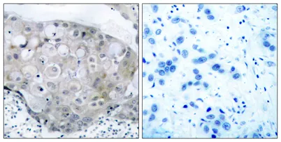 Flk-1/VEGFR2 (phospho Tyr951) rabbit pAb - image 1