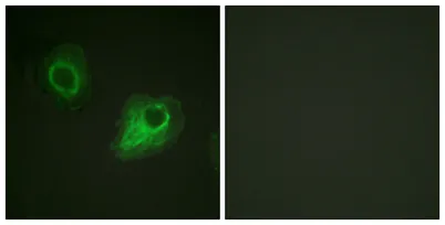 Flk-1/Flt-4 rabbit pAb - image 1