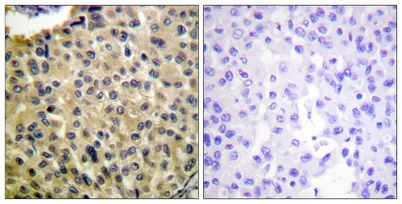 c-Kit (phospho Tyr703) rabbit pAb