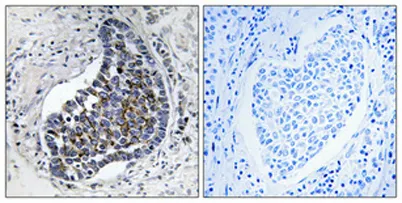 Cytokeratin 8 rabbit pAb