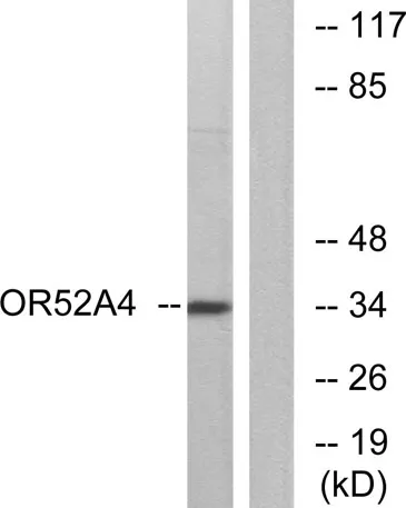 Olfactory receptor 52A4 rabbit pAb