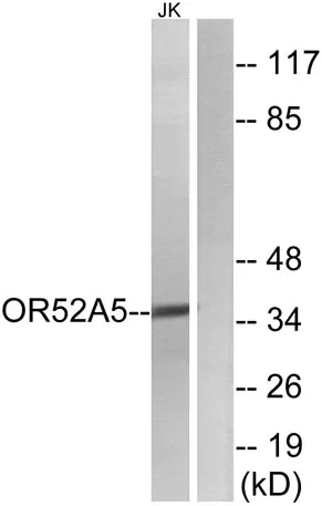 Olfactory receptor 52A5 rabbit pAb