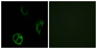 Olfactory receptor 51I1 rabbit pAb