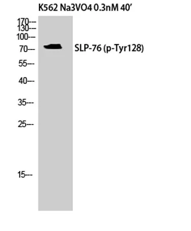 SLP-76 (phospho Tyr128) rabbit pAb - image 1