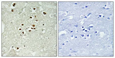DNA Ligase IV (phospho Thr650) rabbit pAb