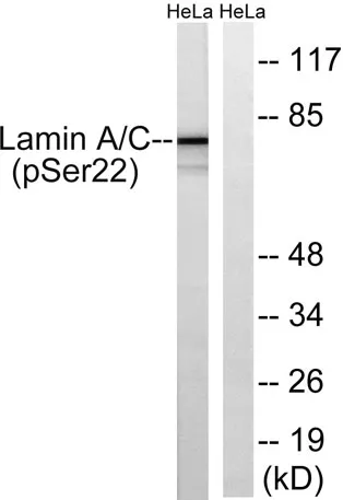 Lamin A/C (phospho Ser22) rabbit pAb