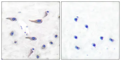 MARCKS (phospho Ser163) rabbit pAb